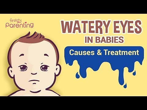 Watery Eyes (Epiphora) In Infants - Causes & Treatment