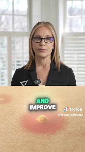 When to Start Using Alpha Hydroxy Acids (AHAs)