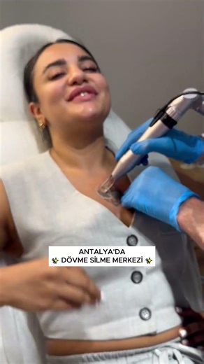 Dövme Sildirme Acıyor mu? Gerçek Hasta Deneyimi! #tattooremovalantalya#tattooremovalturkey