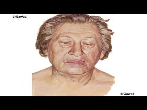 Endocrine: Lecture 18 - Practical Revision