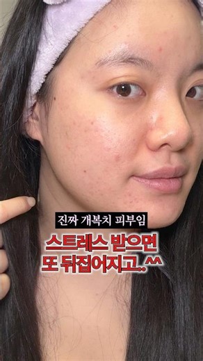 Items my super-super sensitive skin 💸bought with my own money and stocked up on for 900,000 won