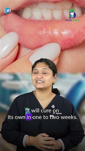 வாய்ப்புண் தானாகவே சரியாகுமா? - Stomatitis and aphthous ulcer | Dr.Aparna | Denta Kings