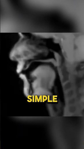 MRI Reveals Beatboxing Skills