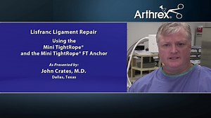 Lisfranc Ligament Repair Using the Mini TightRope® and the Mini TightRope® FT Anchor