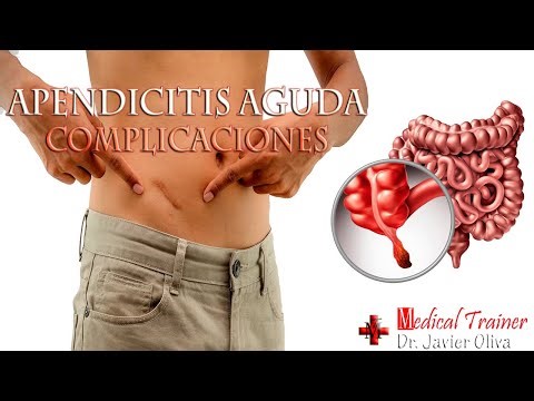 💀ACUTE APPENDICITIS 🏥COMPLICATIONS: Local and Distant 🚑