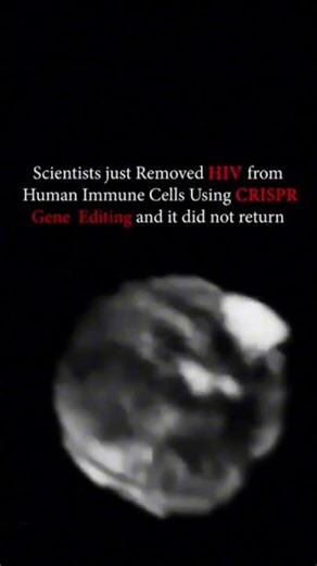 Just in Scientists have successfully removed HIV from human cell. #sciencediscovery #shorts #science