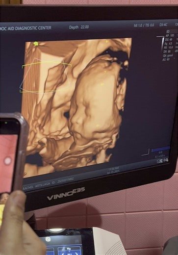 4D Ultrasound Experience of Our Baby Thamara