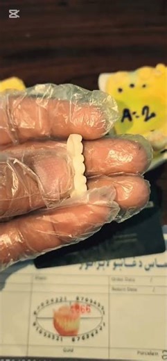 Zirconia Exocad Library Training | Perfect Dental Design #exocad #zirconia #dentallab #dentalshorts