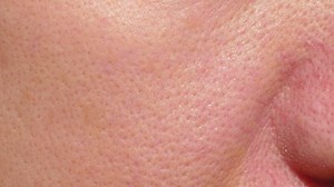Human skin close-up. The flabby skin of an old woman with wrinkles and pores. Problems of aging.