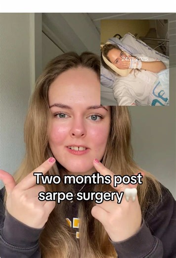 Two Months Post-SARPE Surgery: My Healing Journey