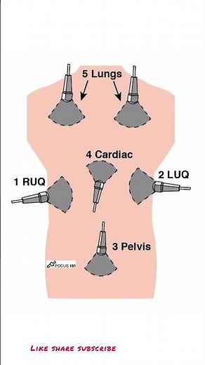 What is FAST scan???# emergency medicine # radiology #quickreview.