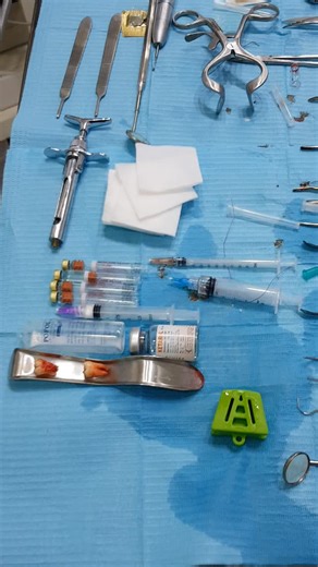 Premier Dentistry on Instagram: "Bilateral wisdom teeth surgery under deep IV sedation For more info 03175857372 44 Upper Ground Floor Civic Centre Phase 4 Bahria Town Islamabad"