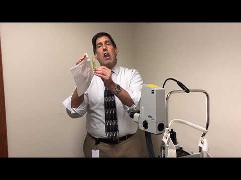 Posterior Capsule Opacification and YAG Laser Capsulotomy