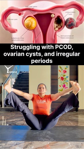Natural Ways to Manage Ovarian Cysts & PCOD✨🧘‍♀️#shorts#yoga