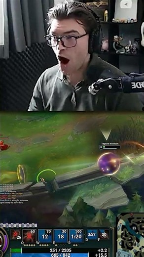 Mogging Everyone With BARD TOP 😤😎