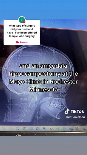 #answer to @lauranorris09 Major brain surgery. #brainsurgery #mayoclinic