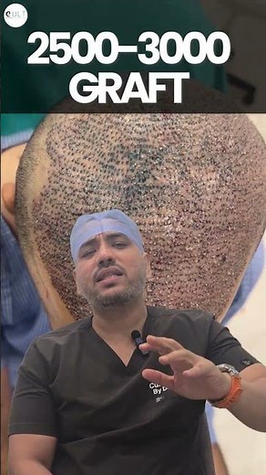 👉 “Hair Transplant Graft Count Explained | How Many Grafts Do You Need?”