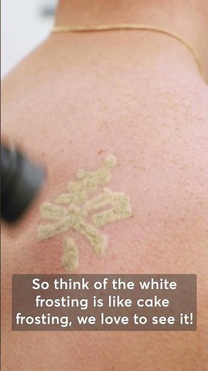 Laser Tattoo Removal Process