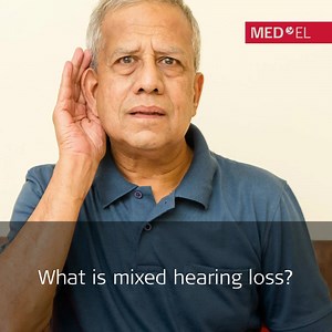 89 reactions · 21 shares | Ever wondered what mixed hearing loss is? Find out more here: https://www.medel.com/about-hearing/types-of-hearing-loss | MED-EL | Facebook