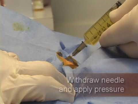 Suprapubic Taps and Aspiration | Simple Explanation for Medical Learners