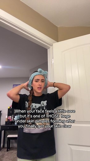 Then you go to talk to someone and they can’t help but stare at it💀 and makeup doesn’t help #fyp #foryou #relatable #acne #skincare