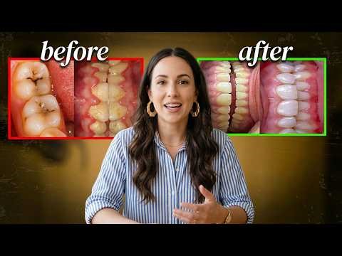 One SIMPLE HABIT that improves your oral health by 106%