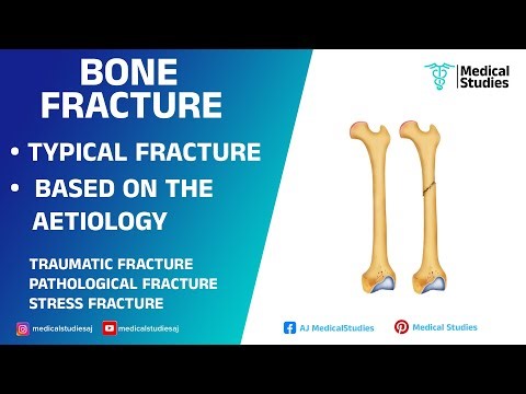 Bone fractures| Types of Fracture| Traumatic Pathological Stress| Medical studies| @medicalstudiesaj