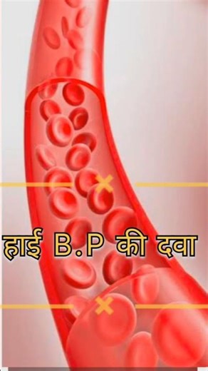 Amlokind At tablet use #shortvideo #trendingshorts