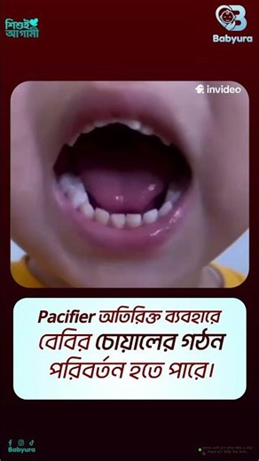 Can Pacifiers Change Your Baby’s Face & Teeth? 😳 | Hidden Risk of Overuse. #babyura #pacifier #baby