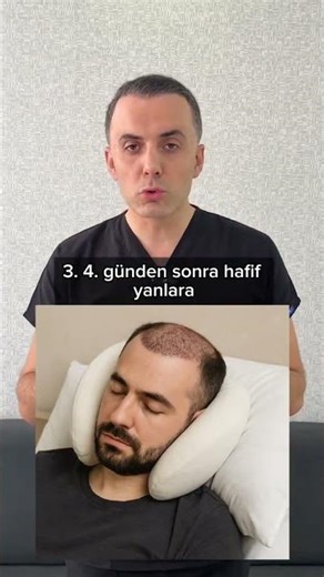 Saç ekimi sonrası şişlik olmasın diyorsan bu videoyu mutlaka izle!👆🏻