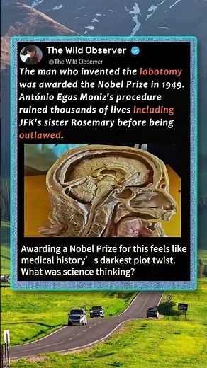 Medical History’s Biggest Mistake! 🧠 #History #DarkHistory #Science