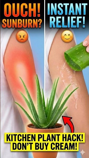How to Use Aloe Vera for Sunburn (Natural Remedy) 🌿