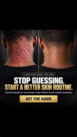 How to Get Rid of Razor Bumps on Your Scalp