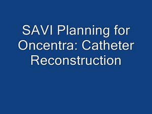 SAVI Planning with Oncentra-Catheter Reconstruction