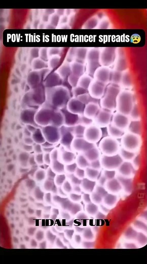 How cancer spreads? | Metastasis explained 🧬✨