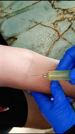 how to collect blood sample properly #science #hospital #bloodcareindia #blooddonation #viral