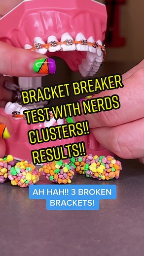 What to Eat with Braces: Nerds Gummy Clusters Guide