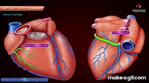 Coronary arteries Anatomy / Blood supply of Heart /  Arterial supply of heart : Animation on Make a GIF