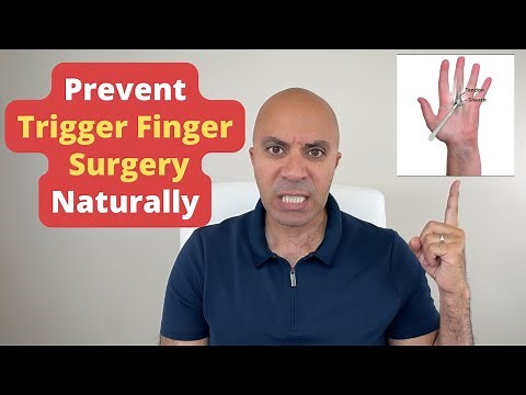 Prevent Trigger Finger Surgery! 3 Shocking *Secret* Natural Steps For Lasting Relief