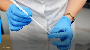 Sharp rise in STDs prompts call for changes