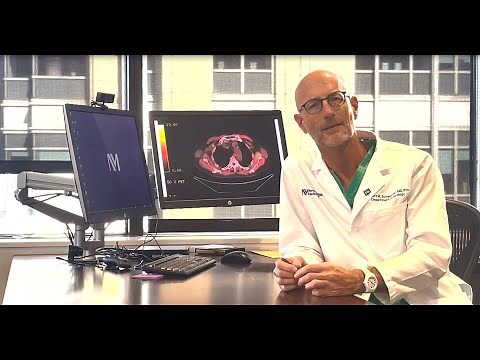 Case Report: Detecting False-Positive PET PSMA in the Evaluation of Prostate Cancer