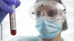 Female lab assistant is working with a blood sample. Analyzing a blood sample in vitro. Covid-19.