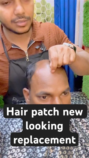 hair weaving vs hair patch, #shorts #trending #haircare