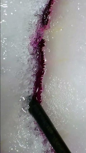 Onion under a microscope