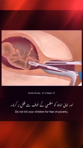 Embrace I Qur’an on Instagram‎: "Share for Sadaqa E Jariyah 💔🥺 Do not ki__11 your children for fear of poverty. We provide for them and for you. Surely ki___11___ ing them is a heinous sin NIKAH is EASY but your CULTURAL Expectations AIN'T! ________________________ The Prophet ﷺ said: “The best of marriages is that which is most affordable.” 📚 Dawud 2117 (Sahih) _______________________ Ma'qil bin Yasar said: "A man came to the Messenger of Allah and said: 'I have found a woman who is from a g