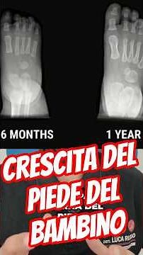 Children's feet: growth and development revealed #kinesiologist #health #sportsforall #children