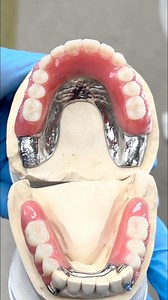 130K views · 863 reactions | Upper and Lower Cast Metal Try-Ins! Case from Dr. Cody Haas in Idaho! FAIRVIEW DENTAL | Luke Kahng | Facebook
