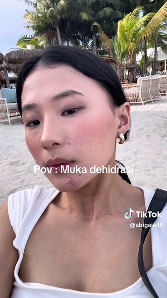 Understanding Oily Skin and Dehydration Symptoms