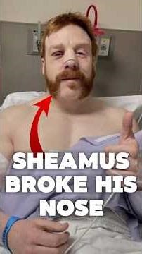 When Sheamus BROKE HIS NOSE #wwe #wrestling #shorts