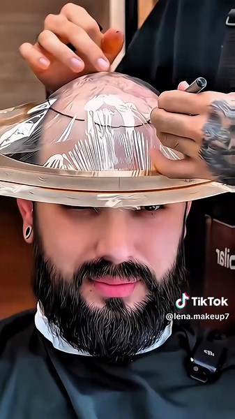 Kids Hair Transplant: Amazing Transformations